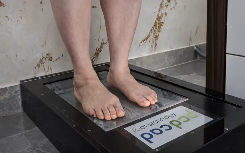 آشنایی با اسکن دیجیتال کف پا