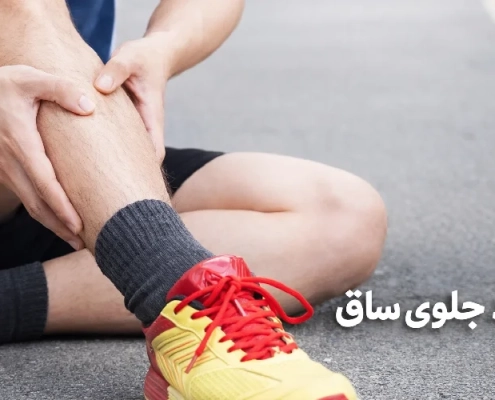 درمان قطعی و سریع شین اسپلینت (درد جلوی ساق پا) بدون جراحی
