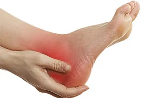 خدمات کلینیک سلامت پردیس در زمینه درد پا
