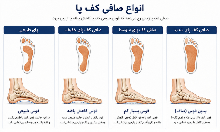 انواع صافی کف پا